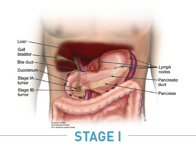 process 9 Your Walk  Pancreas  The End Know PurpleStride to